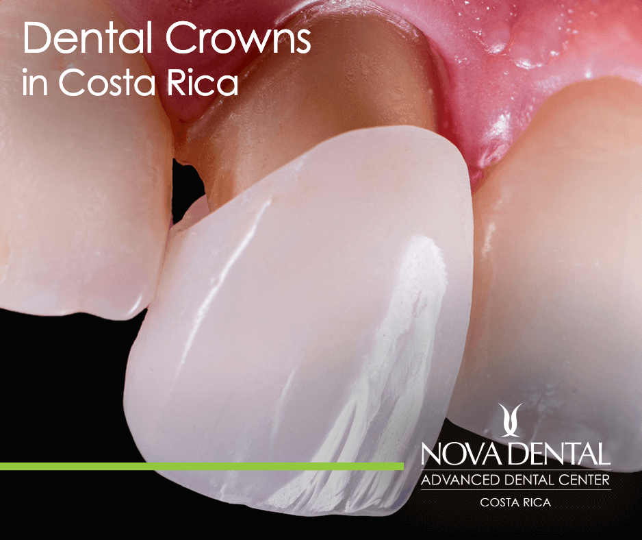 How is a crown attached to a dental implant