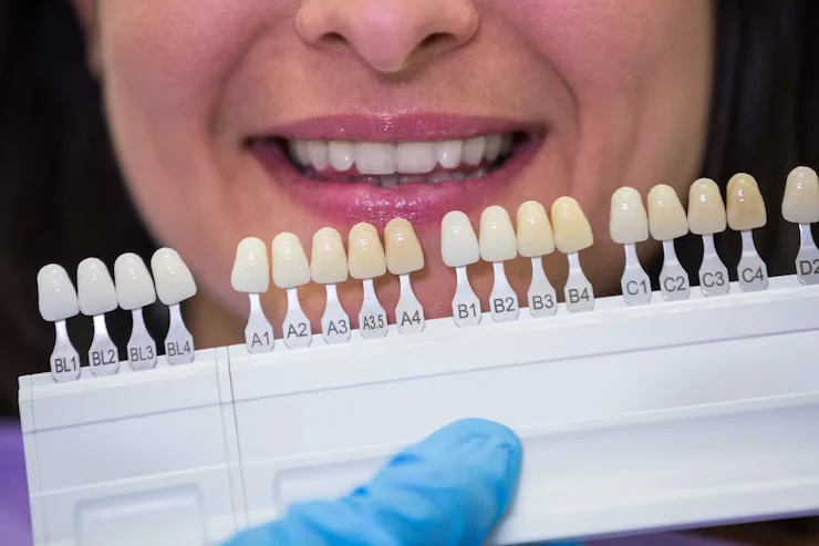 Look at the Safety of Dental Implants