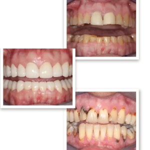 Before and After Gallery